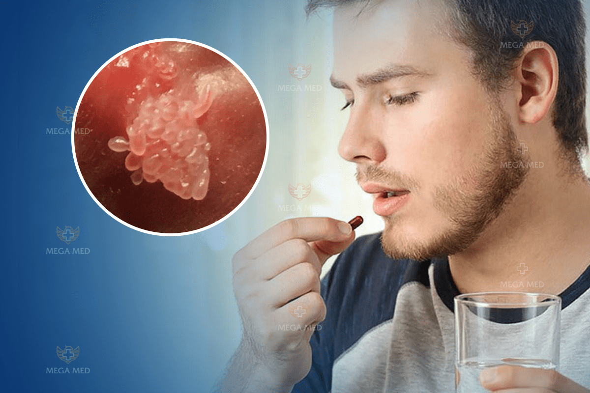 Thuốc trị sùi mào gà theo đường uống